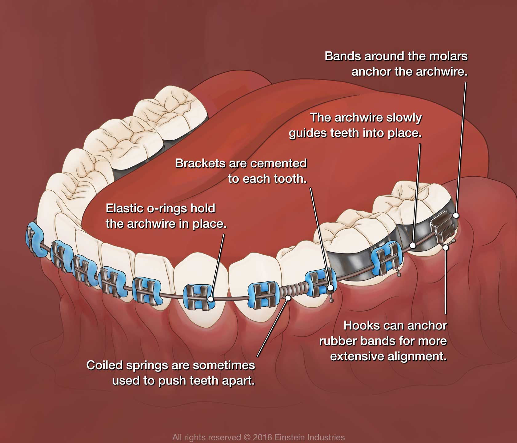 dental cleaning