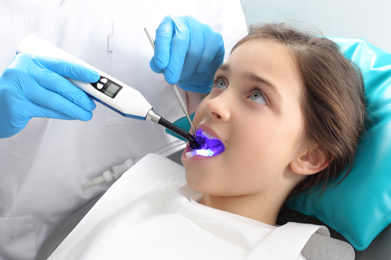 What Are Dental Sealants?