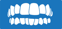 Crowded Teeth