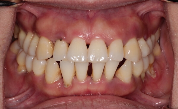 smile gallery image
