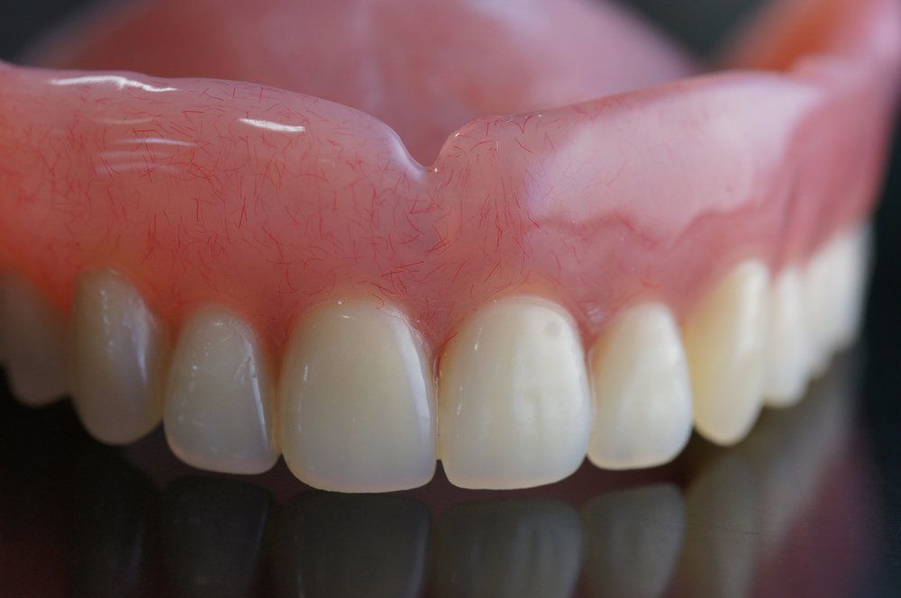 dentures-immediate-dentures