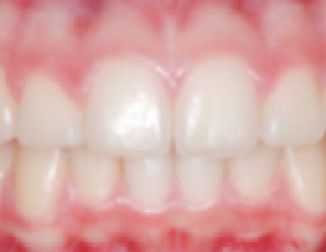 ortho-1-after-1