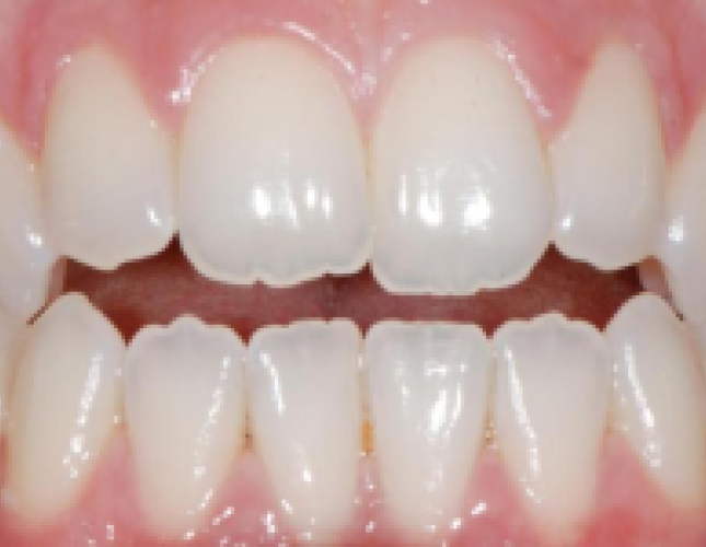 ortho-3-before-1