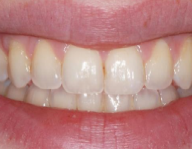 ortho-3-final-1